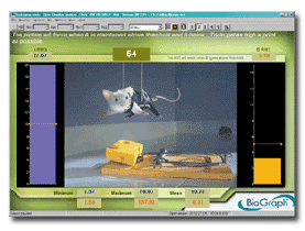 MyoTrac Infiniti U-Control Clinical